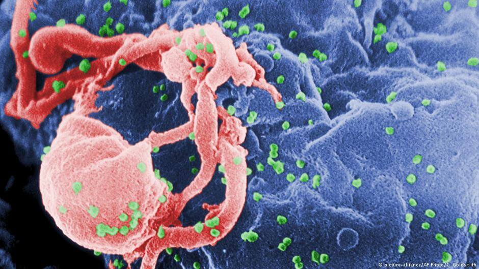 Drugi już pacjent w historii wyleczony z wirusa HIV