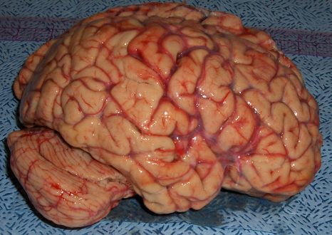 BRAIN TEST – sprawdź która półkula mózgu dominuje u ciebie