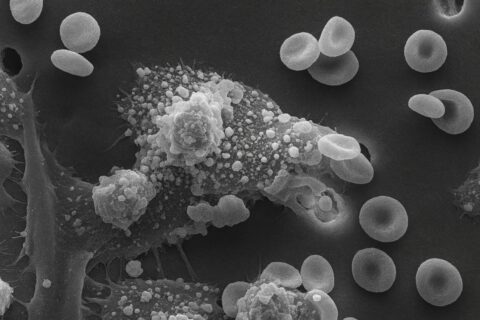 Czy rak naprawdę jest wszędzie? Dlaczego to nie musi być zła wiadomość